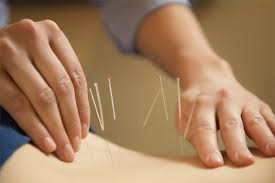 DIPLOMA IN UNANI & ACUPUNCTURE